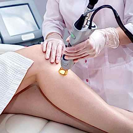 Alexandrite Lazer Epilasyon