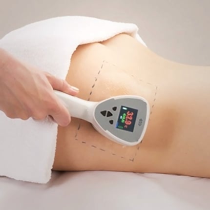 Exilis Ameliyatsız Estetik