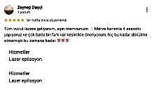 Tüm vücut lazere geliyorum, aşırı memnunum.